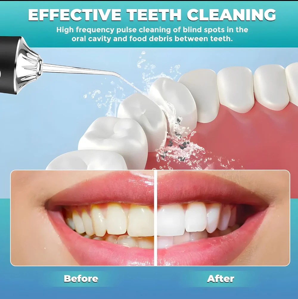 Water Flosser Portable Dental Water Jet Oral Teeth Irrigator Waterproof Tooth Cleaner Water Flosser Oral Flosser 3 Modes And 4 Nozzels