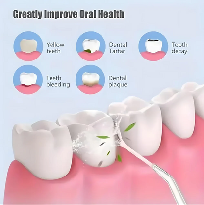 Water Flosser Portable Dental Water Jet Oral Teeth Irrigator Waterproof Tooth Cleaner Water Flosser Oral Flosser 3 Modes And 4 Nozzels